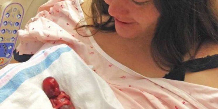 Nakon spontanog pobačaja, majka se iznenadila vidjevši „savršeno oblikovano dijete“