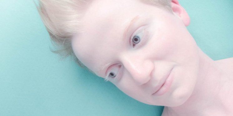 Iako zbog albinizma gotovo ne vidi, Ana planinari i profesionalno se bavi fotografijom