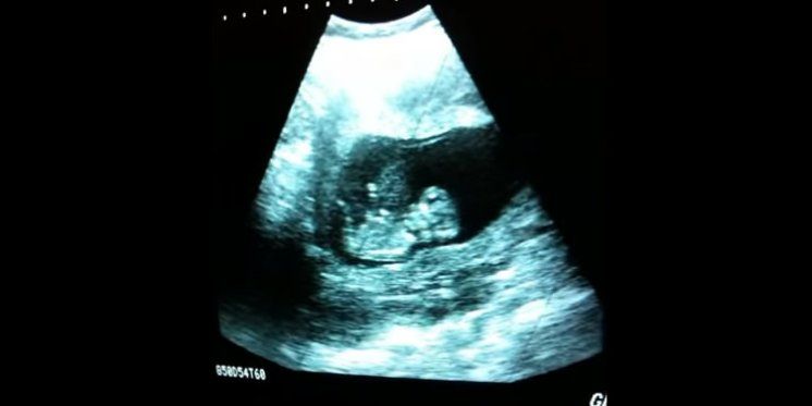 Zadivljujuća ultrazvuk snimka – beba koja se igra! Čudo života