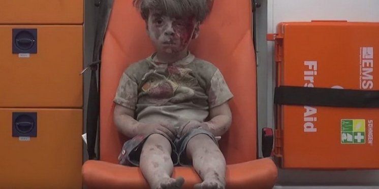 JEZIVI ZVUK TIŠINE Ranjeni dječačić rasplakao svijet i postao novi simbol Alepa