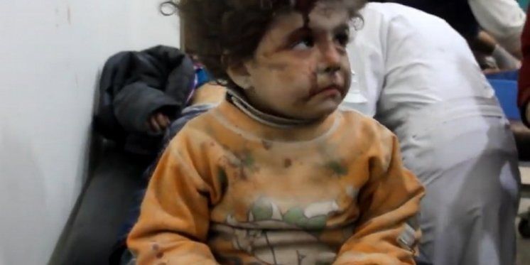VIDEO Da vam srce pukne: Djeca u Alepu od šoka više ni ne plaču