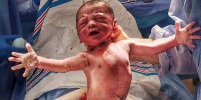 Novorođenče dočekalo „ životno čudo “ raširenih ruku