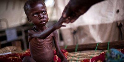 HUMANITARNA TRAGEDIJA U KONGU 400 tisuća djece do pet godina mogla bi umrijeti u 2018. godini 