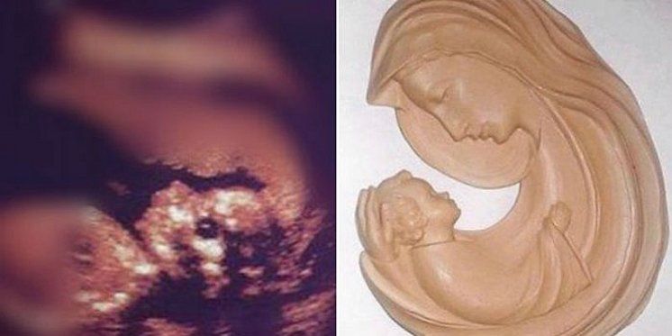 Čudesna slika Djevice Marije koja drži bebu pojavila se na trudničkom ultrazvuku
