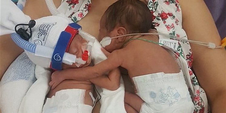 Rastopile srca: Zagrljaj prerano rođenih blizanki oduševio svijet