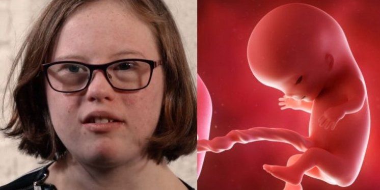 Djevojka s Downovim sindromom bori se protiv prenatalnog testa koji bi mogao izazvati veći broj pobačaja