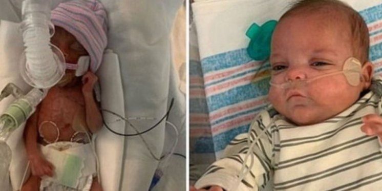 Ide kući nakon 133 dana u bolnici: Čudesna beba rođena sa samo 453 grama