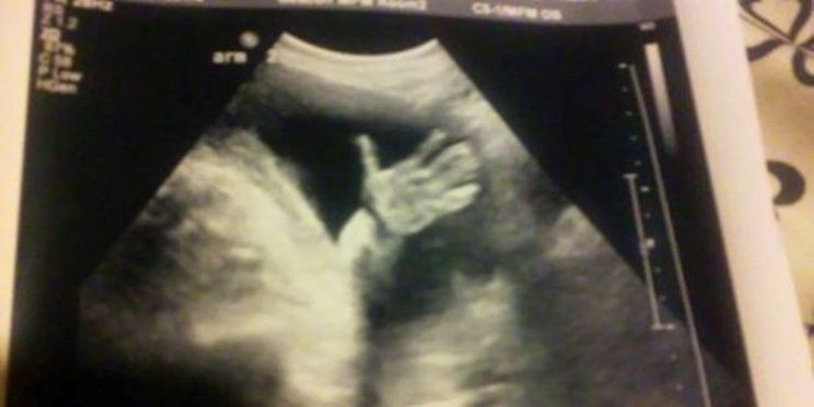 „Bok mama!“: Pozdrav bebe iz majčinog trbuha koja kaže „ne“ pobačaju