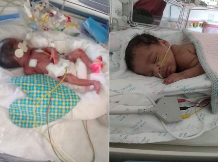 Čudo od bebe čije je srce stalo na 17 minuta: Sad je napokon doma, ali na kisiku